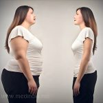 भारतमा मोटोपन घटाउने ‘जादुई चक्की’ सस्तो हुँदै